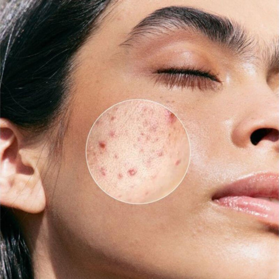 Masque Purifiant Intense 75 ml – nettoie et régule le sébum – Janssen Cosmetics Maroc